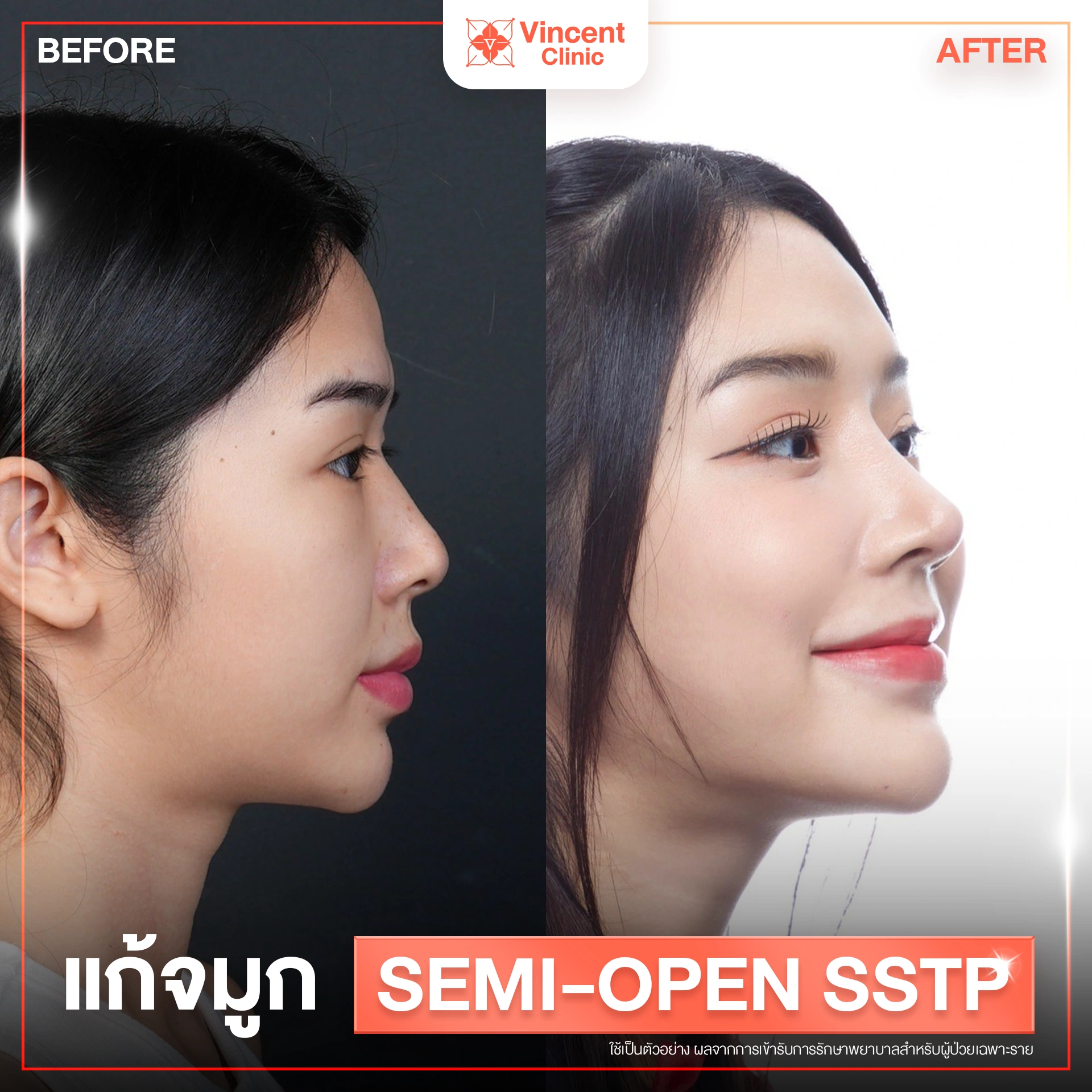 รูปรีวิว