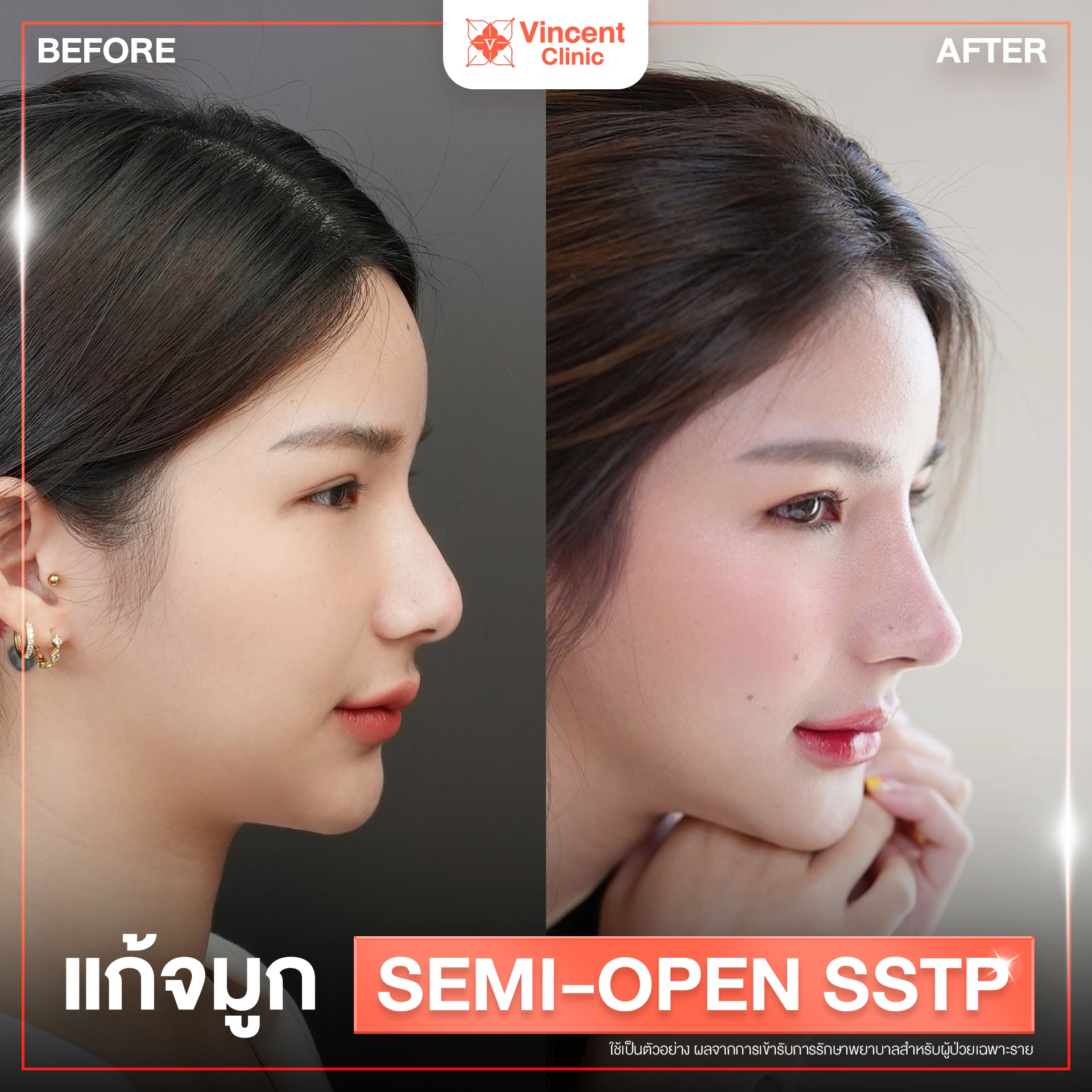 รูปรีวิว