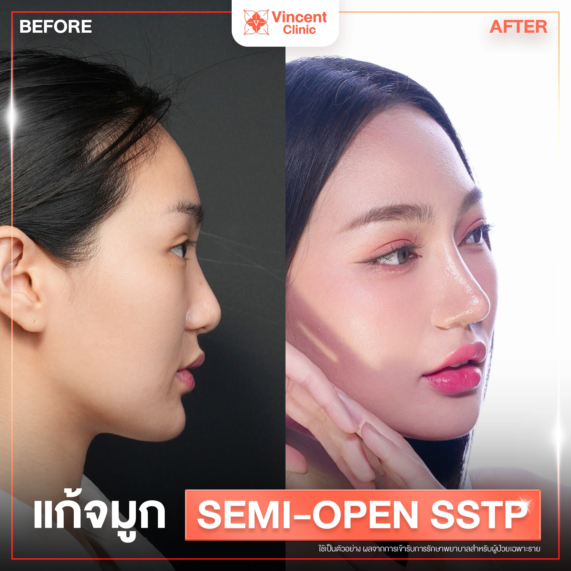 รูปรีวิว