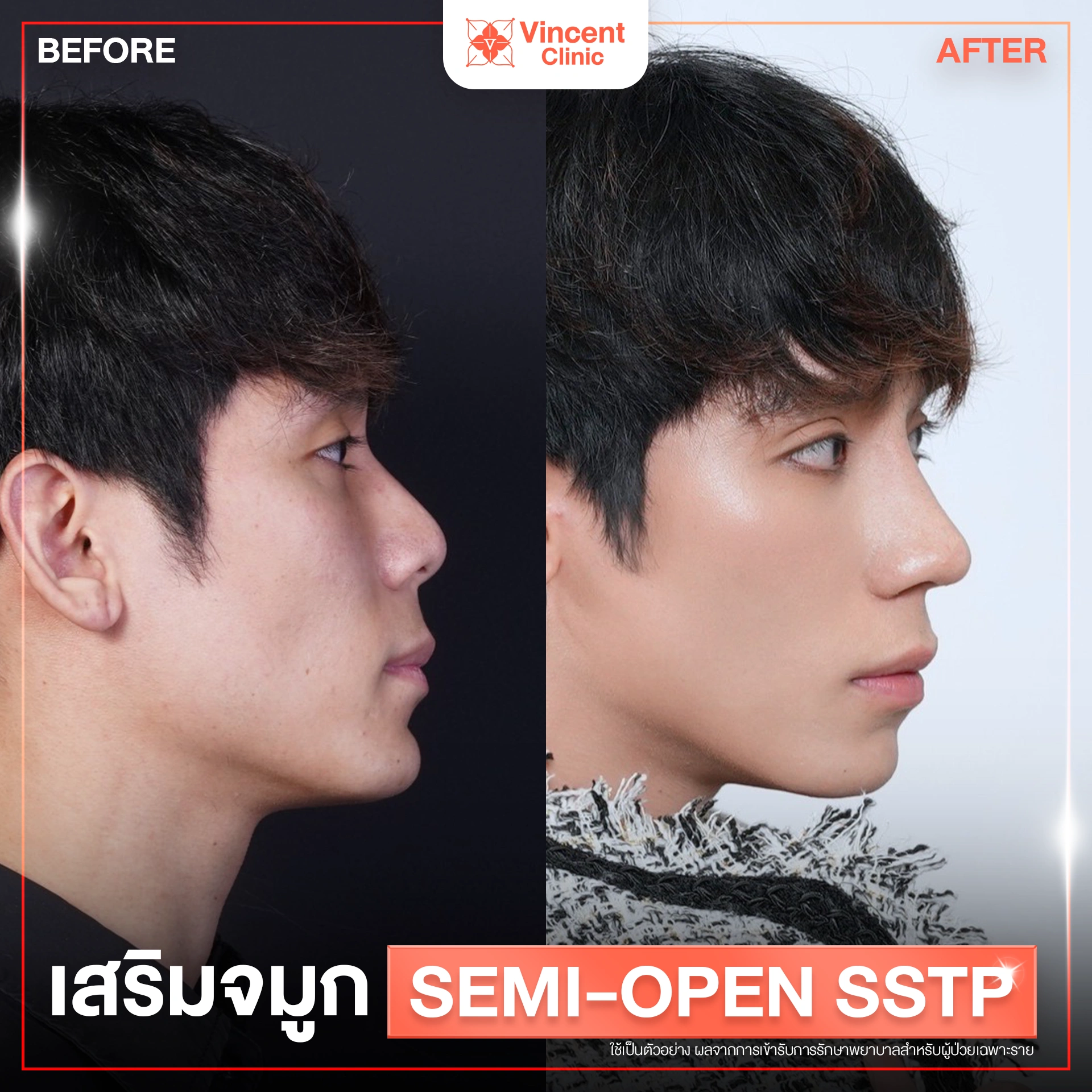 รูปรีวิว
