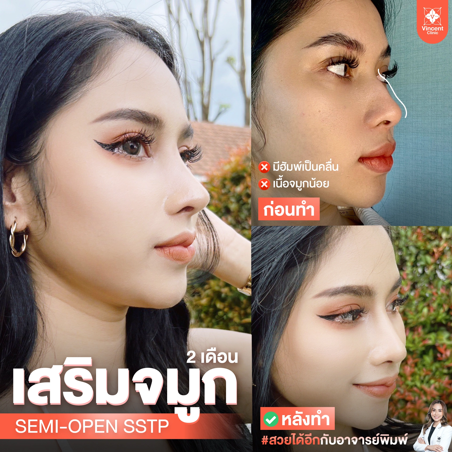 รูปรีวิว