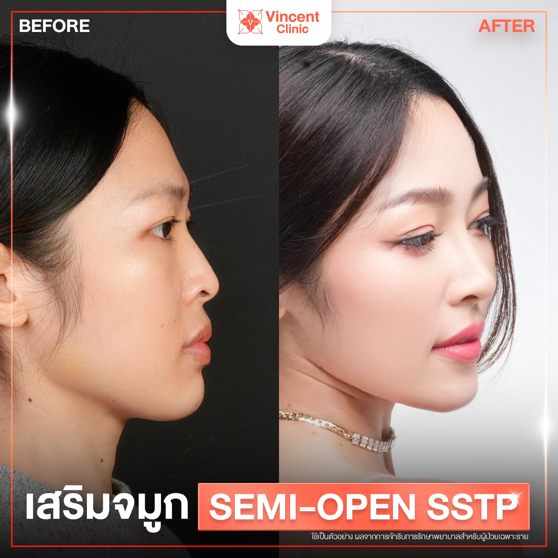 รูปรีวิว
