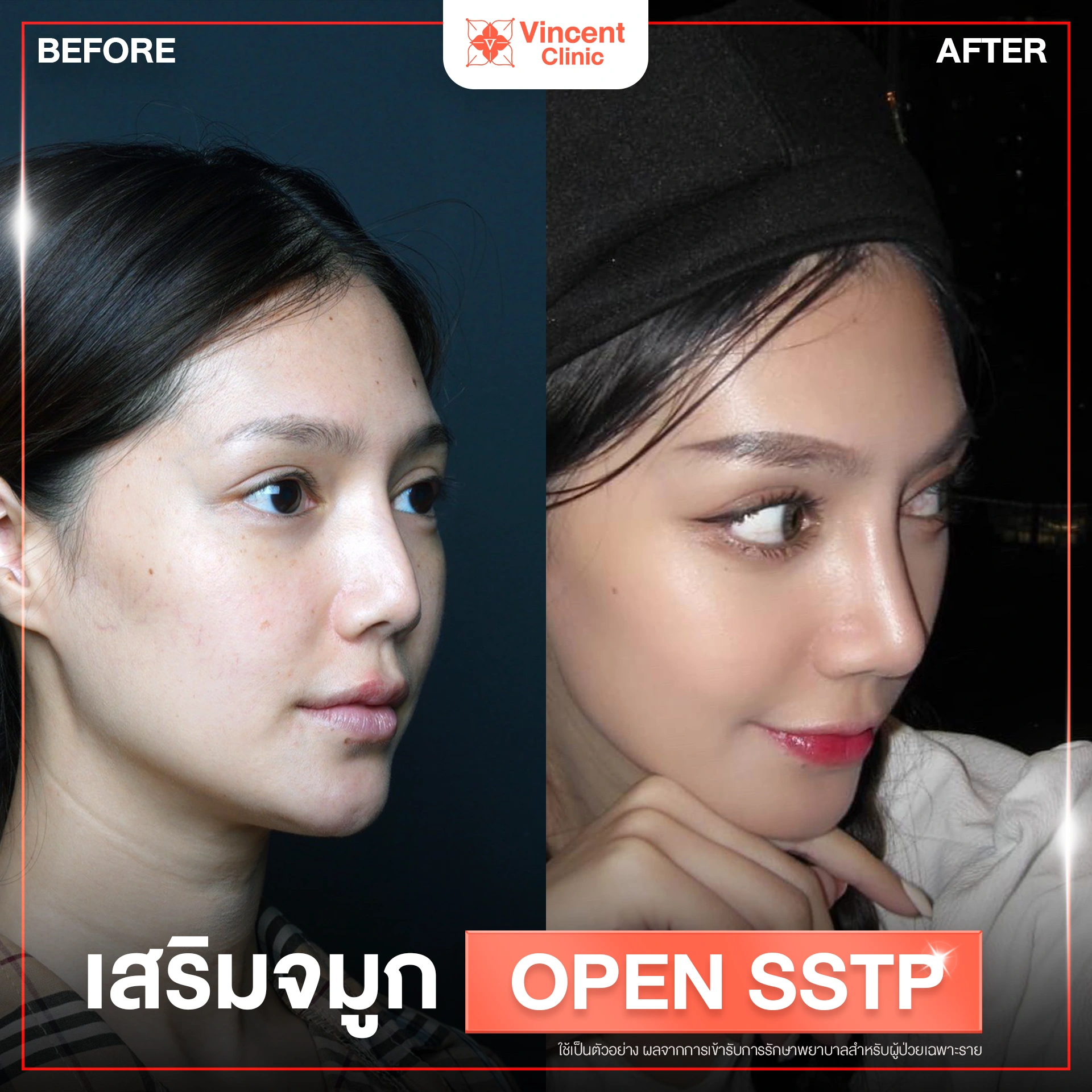 รูปรีวิว