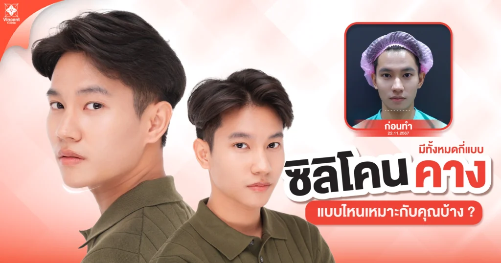 ซิลิโคนคางแบบไหนดี