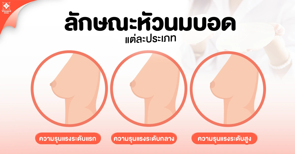 ลักษณะหัวนมบอด