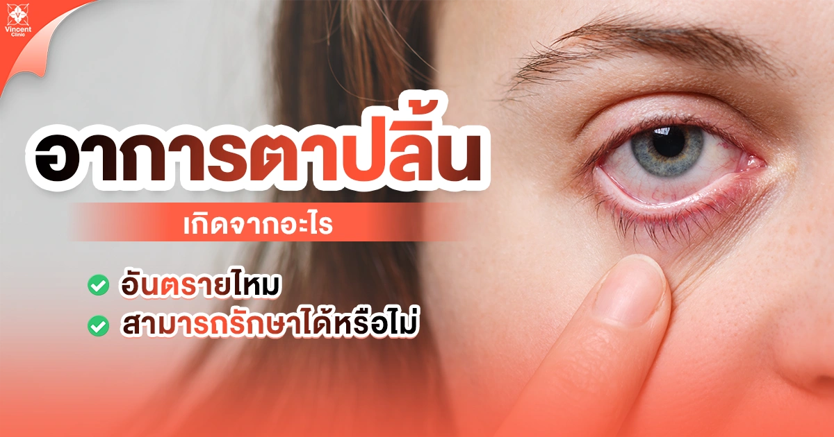 อาการตาปลิ้น