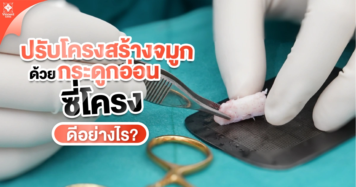 ปรับโครงสร้างจมูกด้วยกระดูกอ่อนซี่โครง