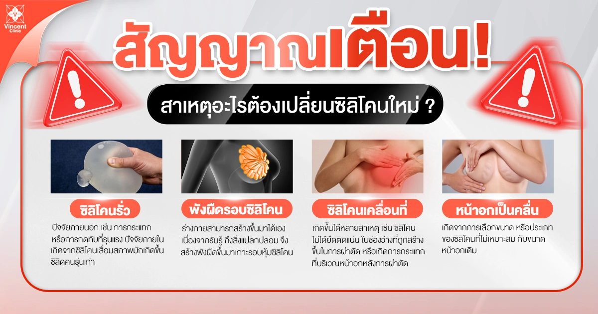 สัญญาณเตือนว่าควรเปลี่ยนซิลิโคน