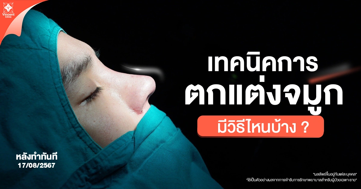 ปรับโครงสร้างจมูก ทำอย่างไรได้บ้าง