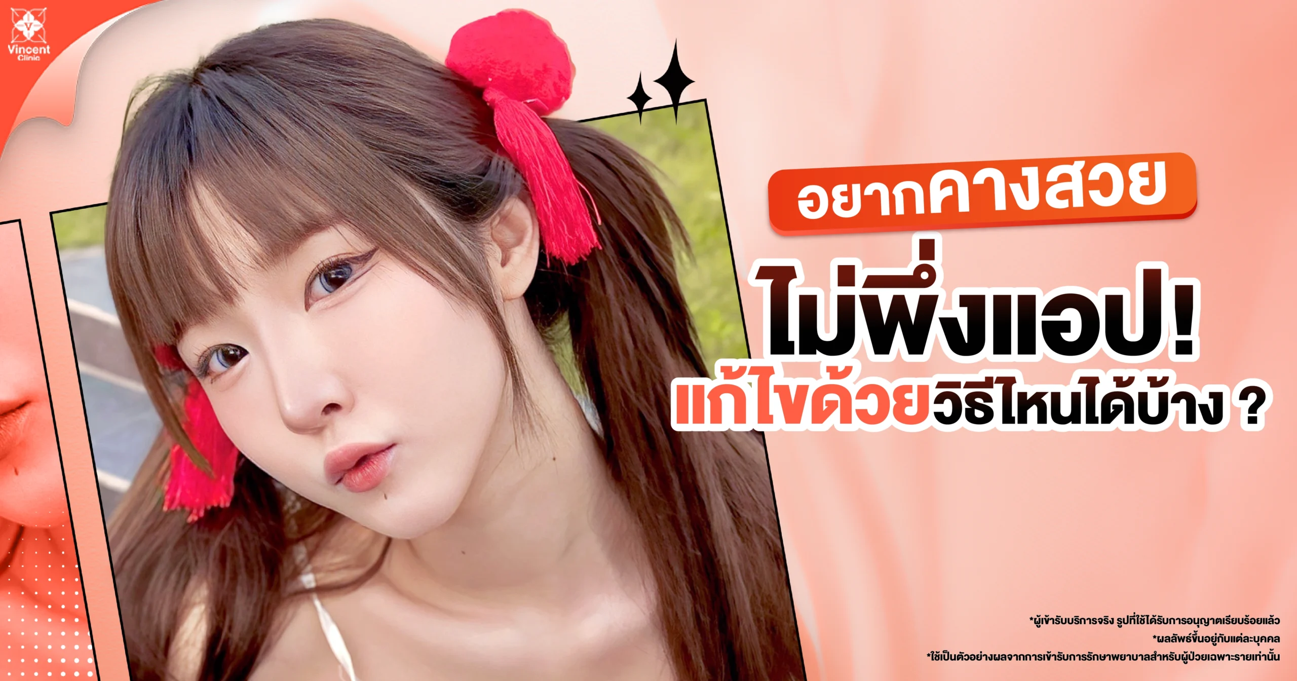 คางสั้น