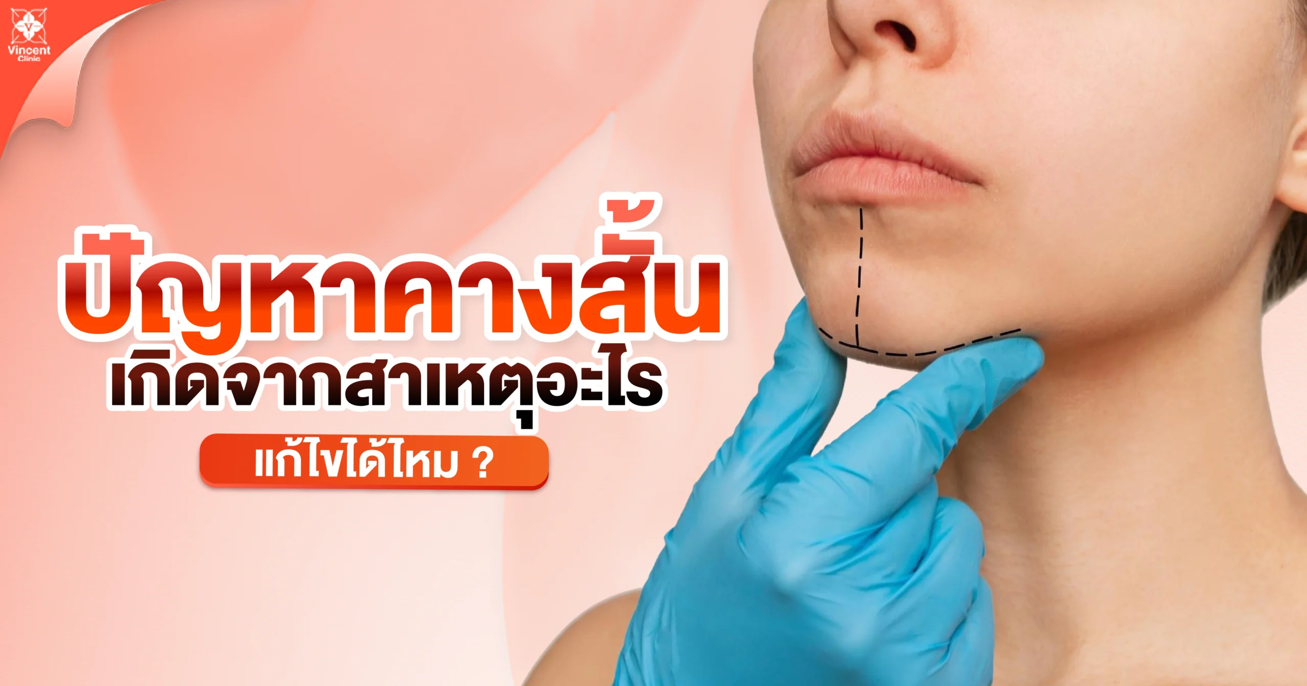 ปัญหาคางสั้น