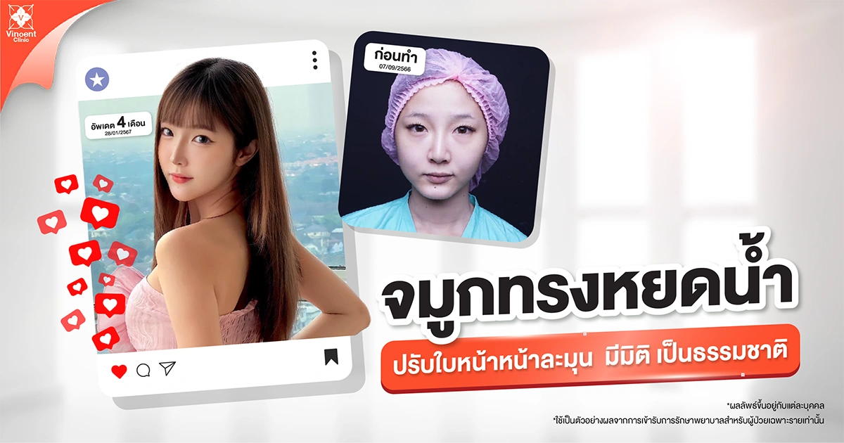 จมูกทรงหยดน้ำ
