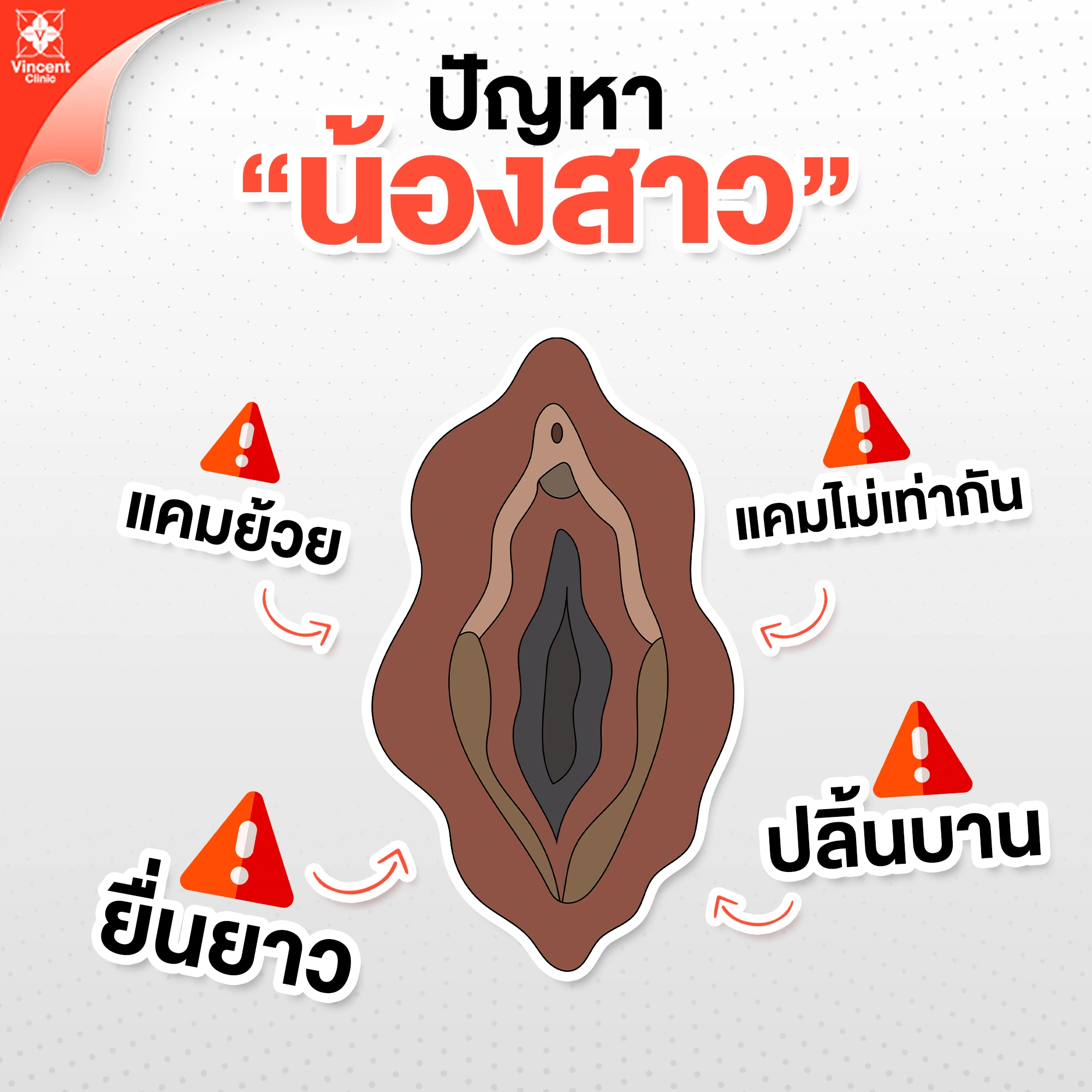 ปัญหาน้องสาว