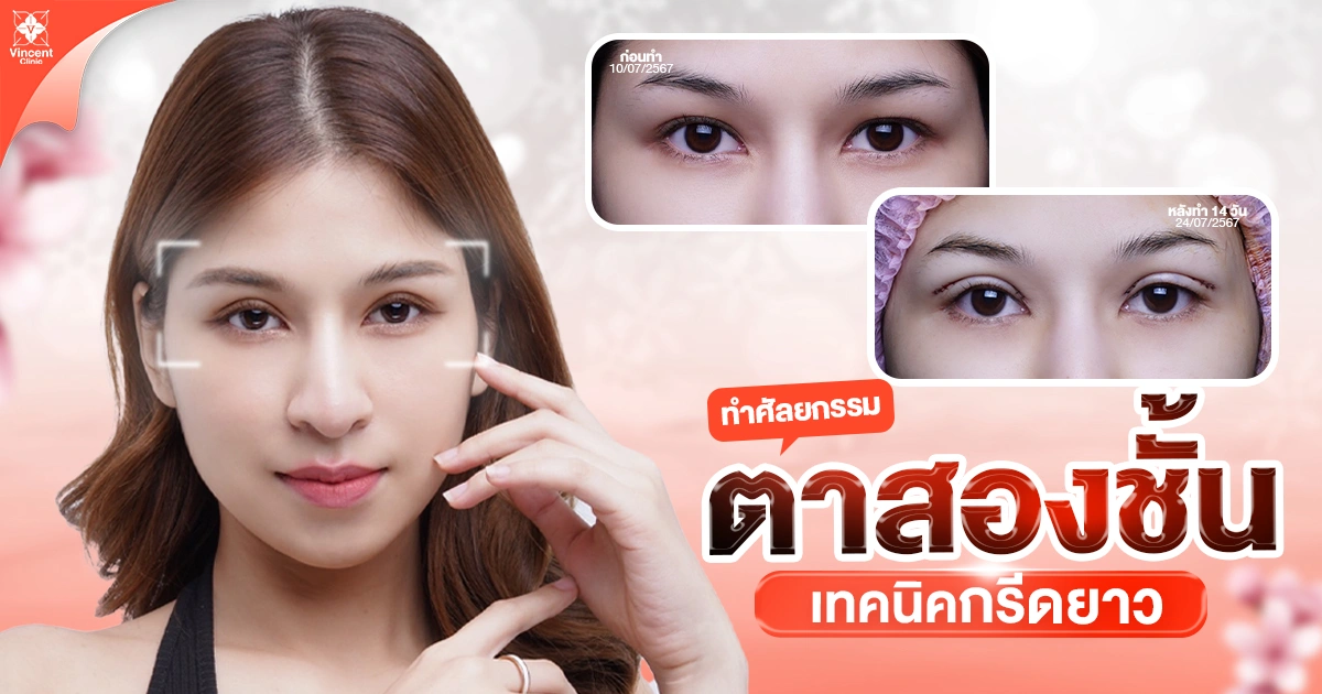 ตาสองชั้นเทคนิคกรีดยาว
