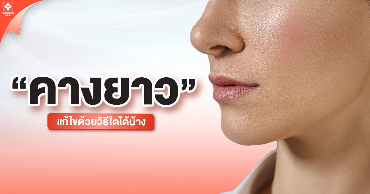 แก้คางยาว มีวิธีไหนบ้าง?
