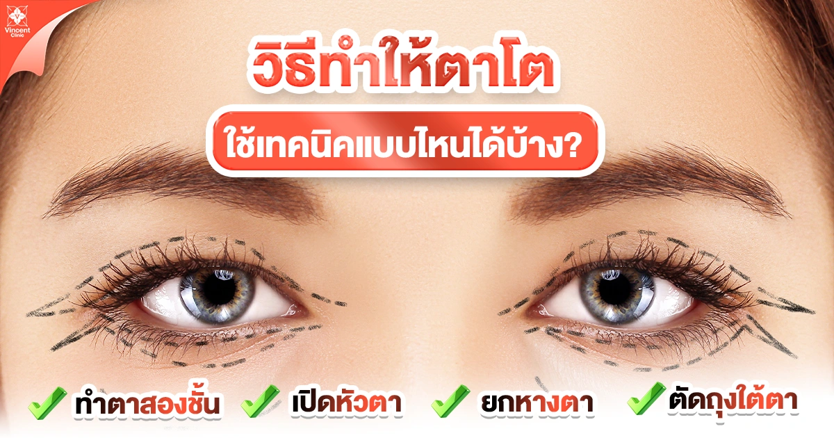 ศัลยกรรมตาโต ใช้เทคนิคแบบไหนได้บ้าง