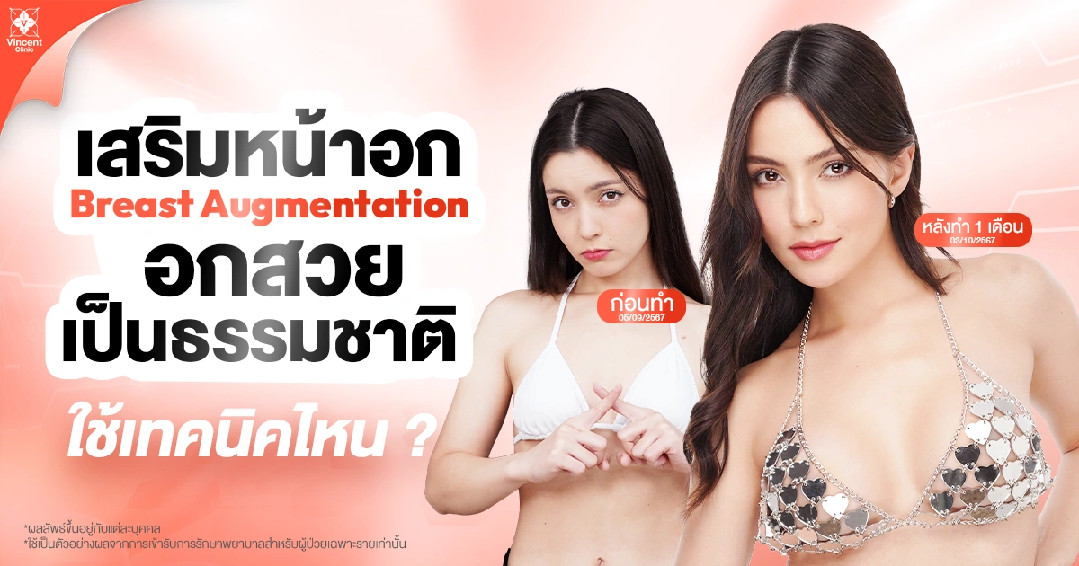 หน้าอกทรงธรรมชาติ