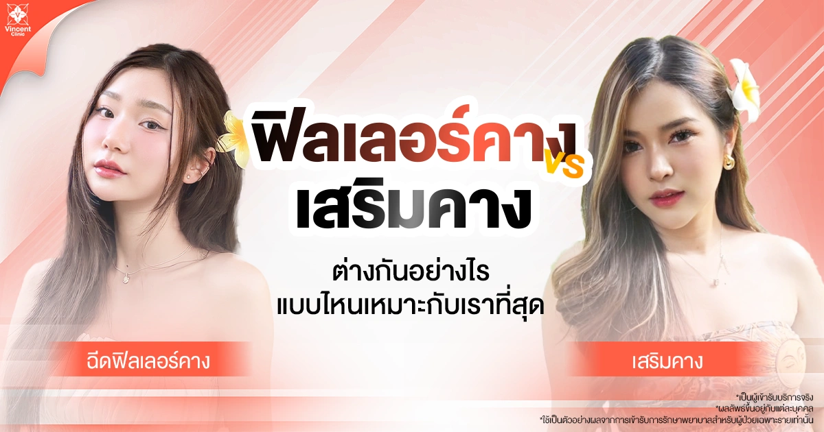 เสริมคาง VS ฉีดฟิลเลอร์คาง