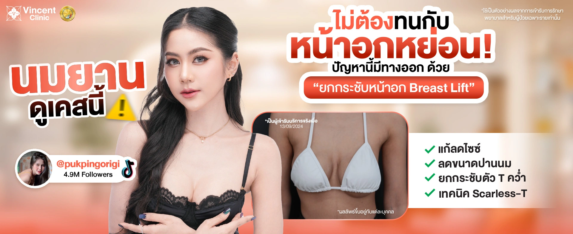 Bannerยกกระชับหน้าอก