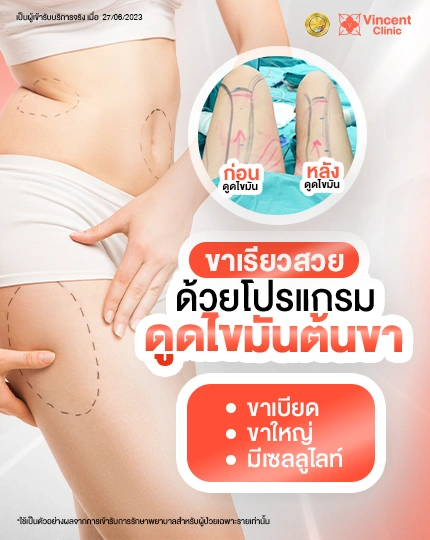 ดูดไขมันขา