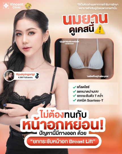 กระชับหน้าอก