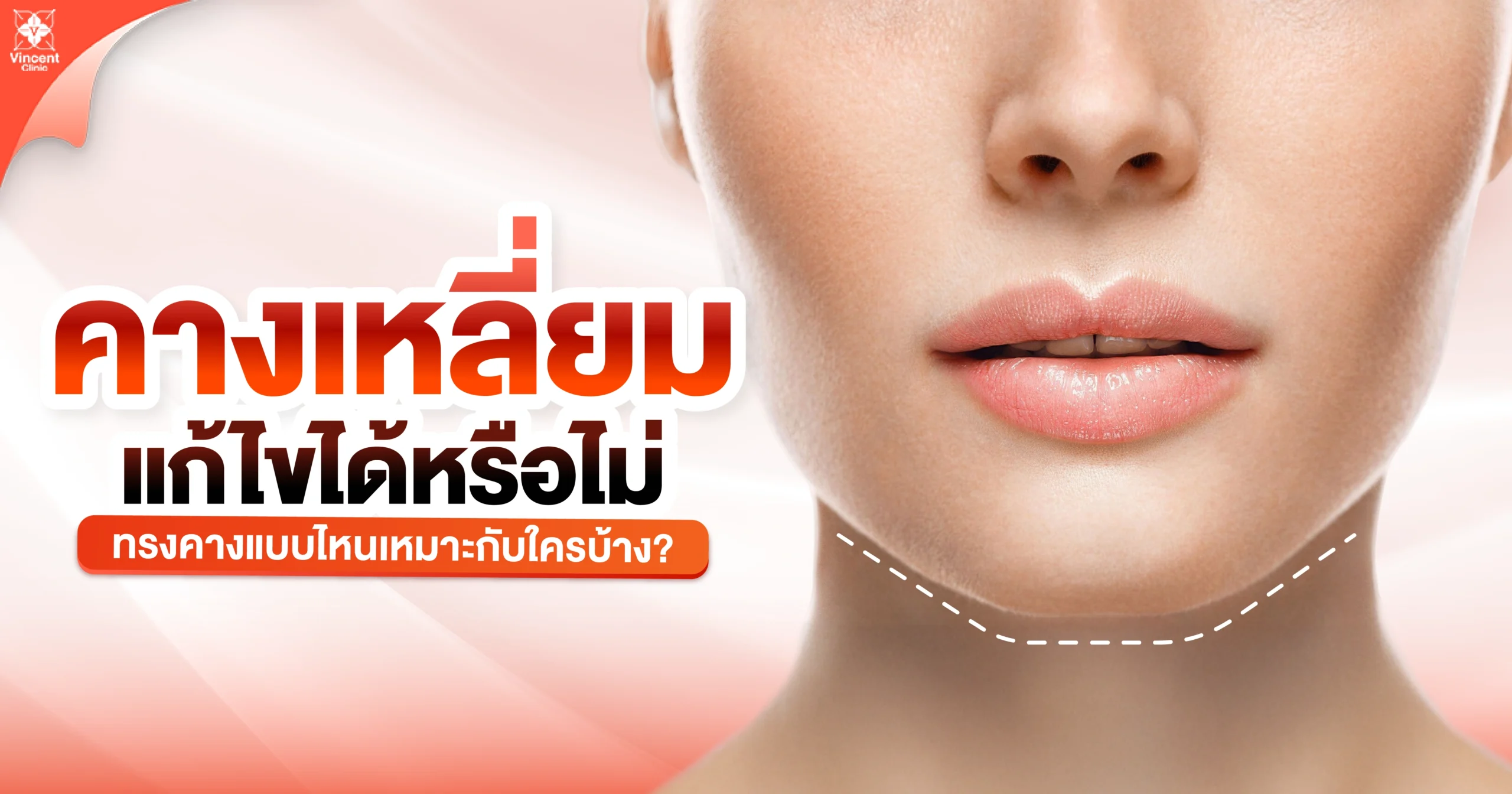 คางเหลี่ยมแก้ไขอย่างไร