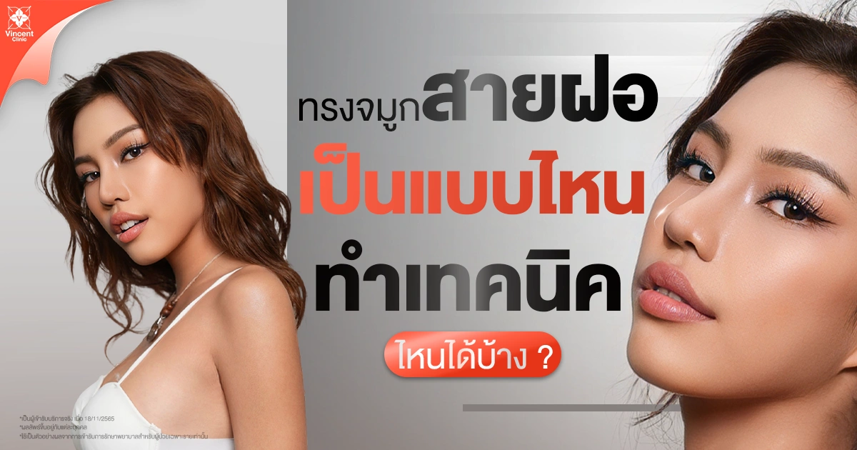 จมูกสายฝอเป็นแบบไหน