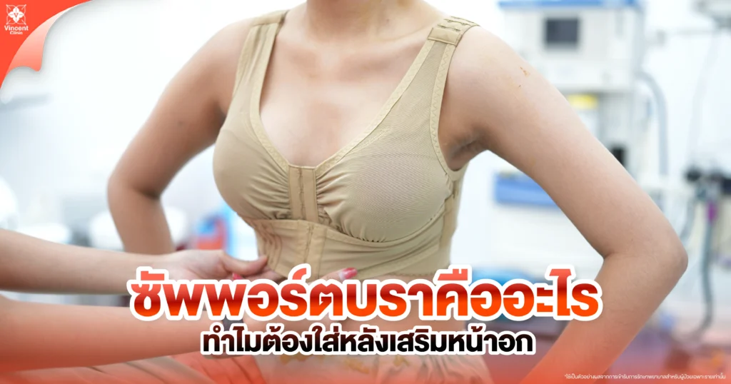 ซัพพอร์ตบาร์คืออะไร