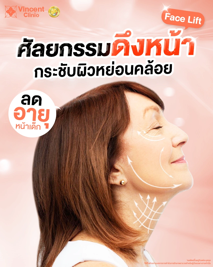 ศัลยกรรมดึงหน้า