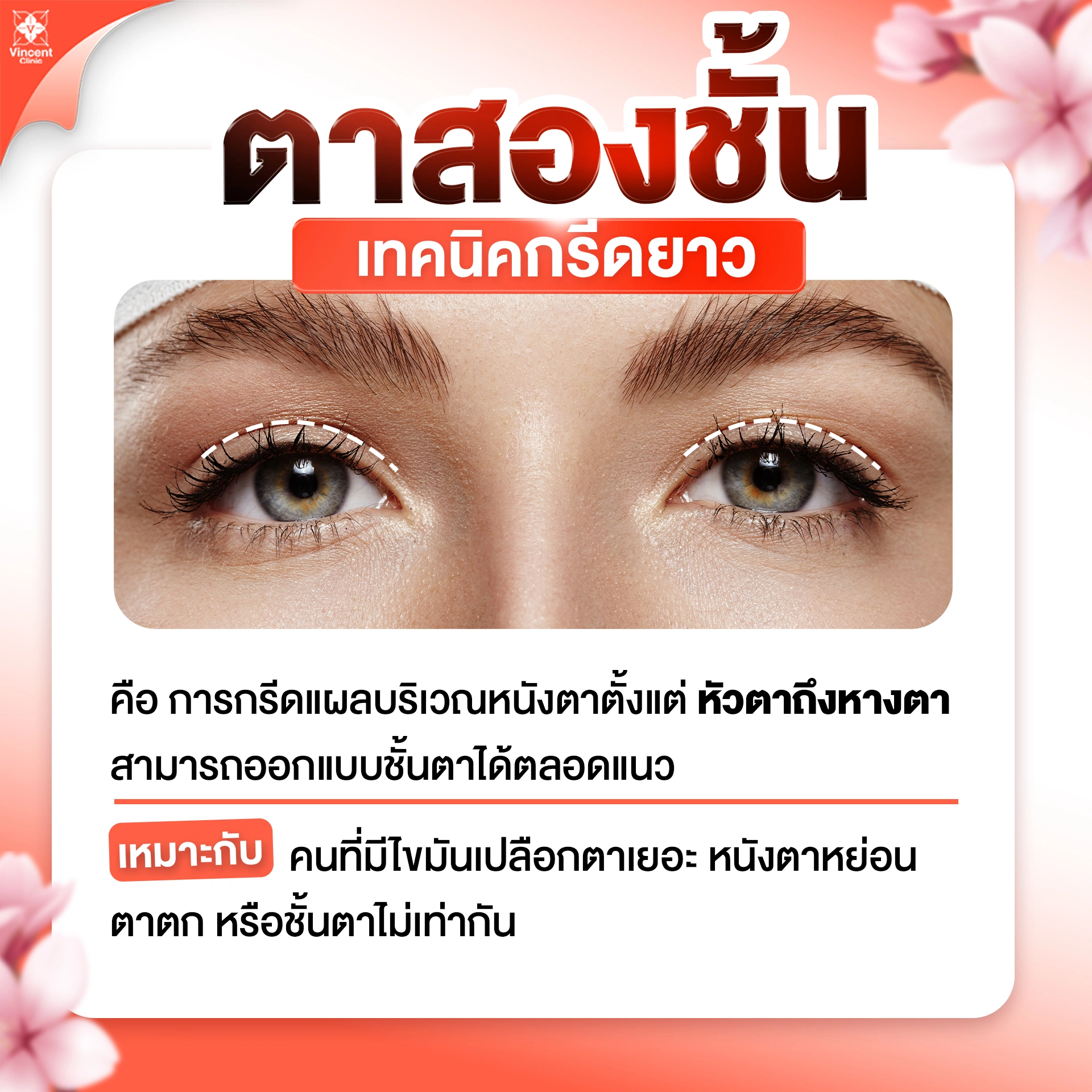 ตาสองชั้น เทคนิคกรีดยาว