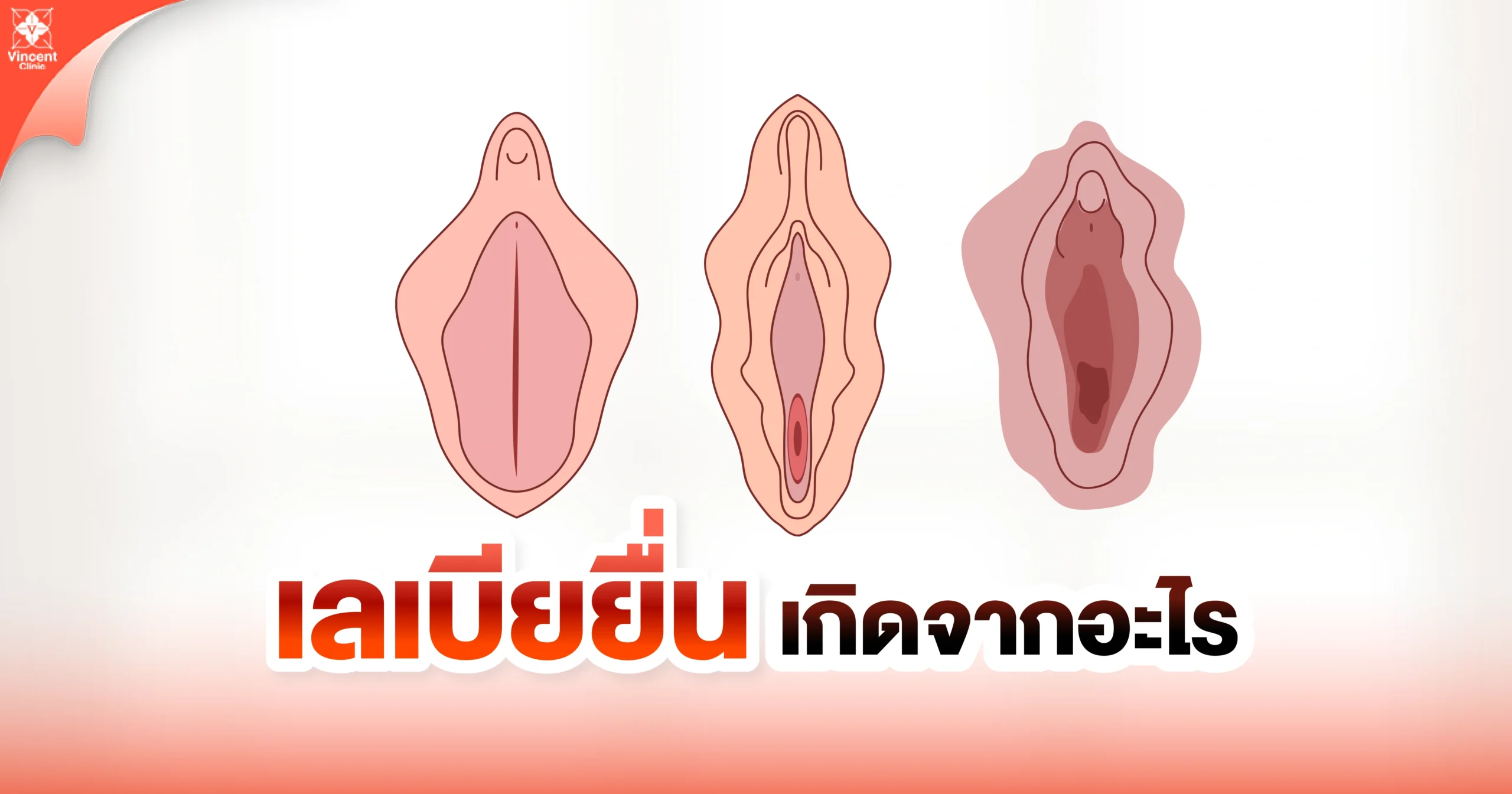 เลเบียยื่น เกิดจากอะไร