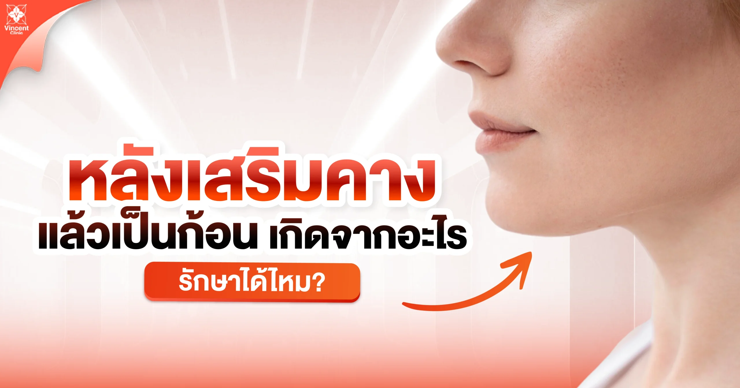หลังเสริมคางแล้วเป็นก้อนเกิดจากอะไร