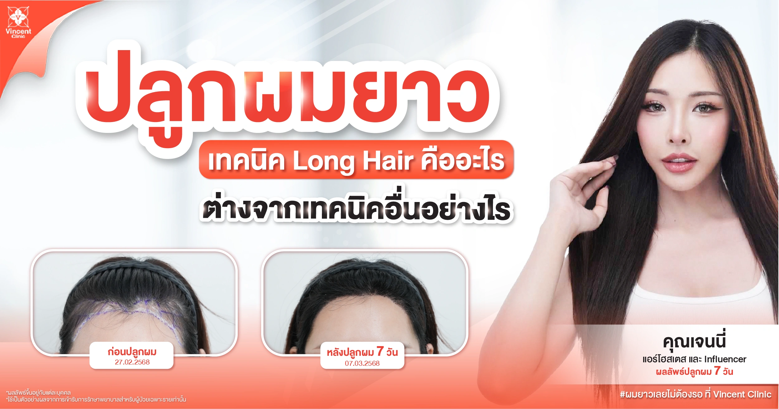 ปลูกผมยาวเทคนิค long hair