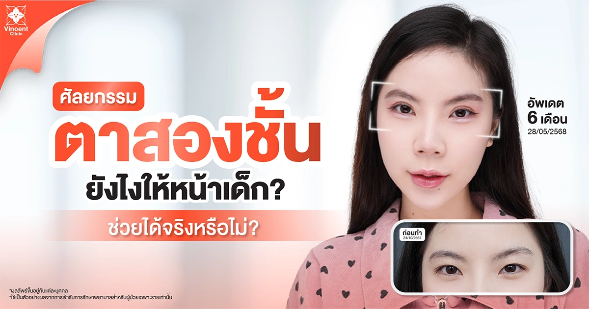 double-eyelid-techniques-for-younger-look