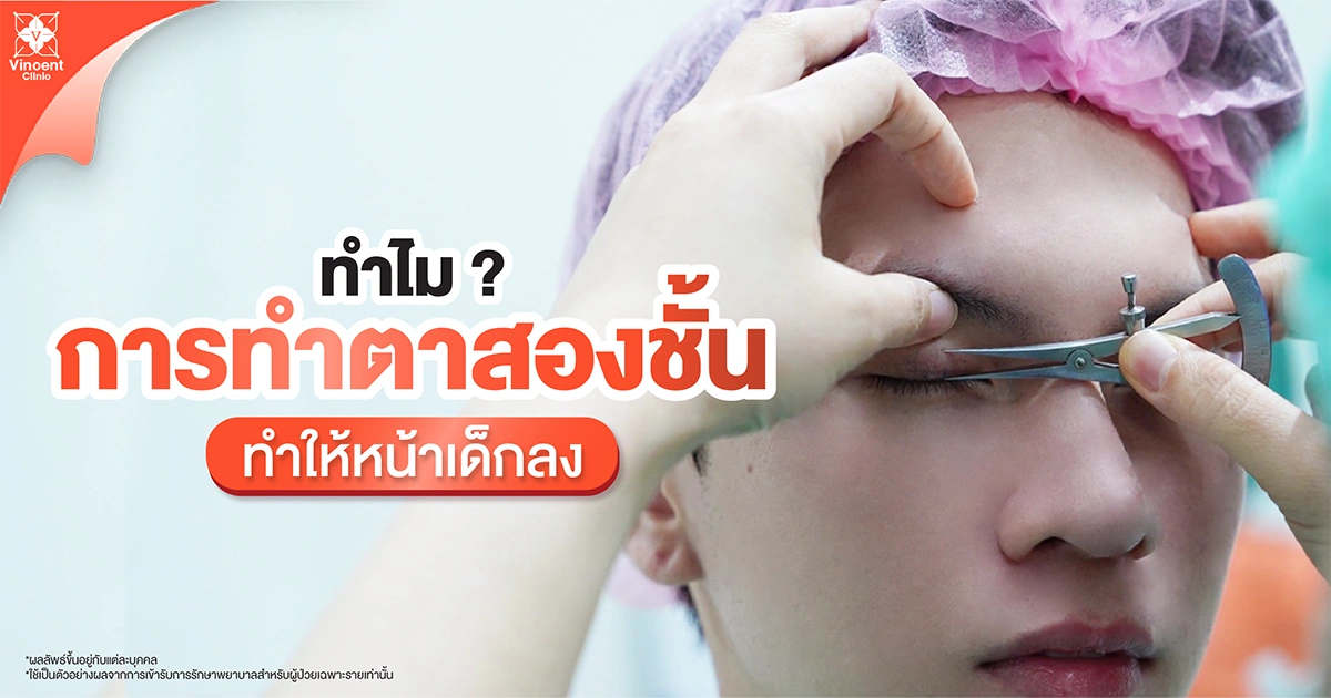 เทคนิคทำตาสองชั้น หน้าเด็ก มีกี่แบบ?