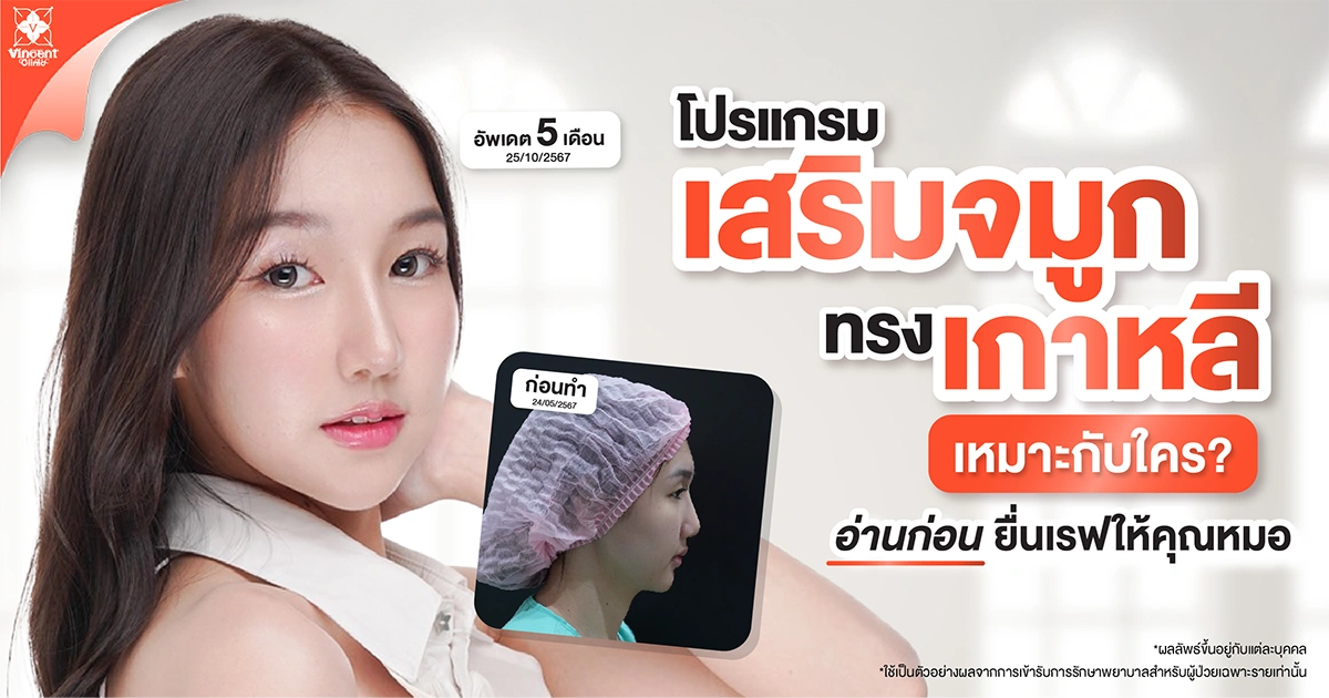 จมูกทรงเกาหลี