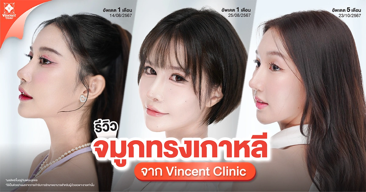 รีวิวและผลลัพธ์จากคนไข้ที่ทำจมูกทรงเกาหลี