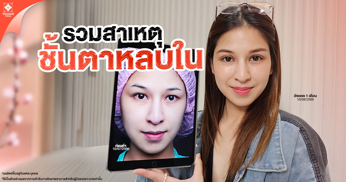 สาเหตุของตาหลบใน