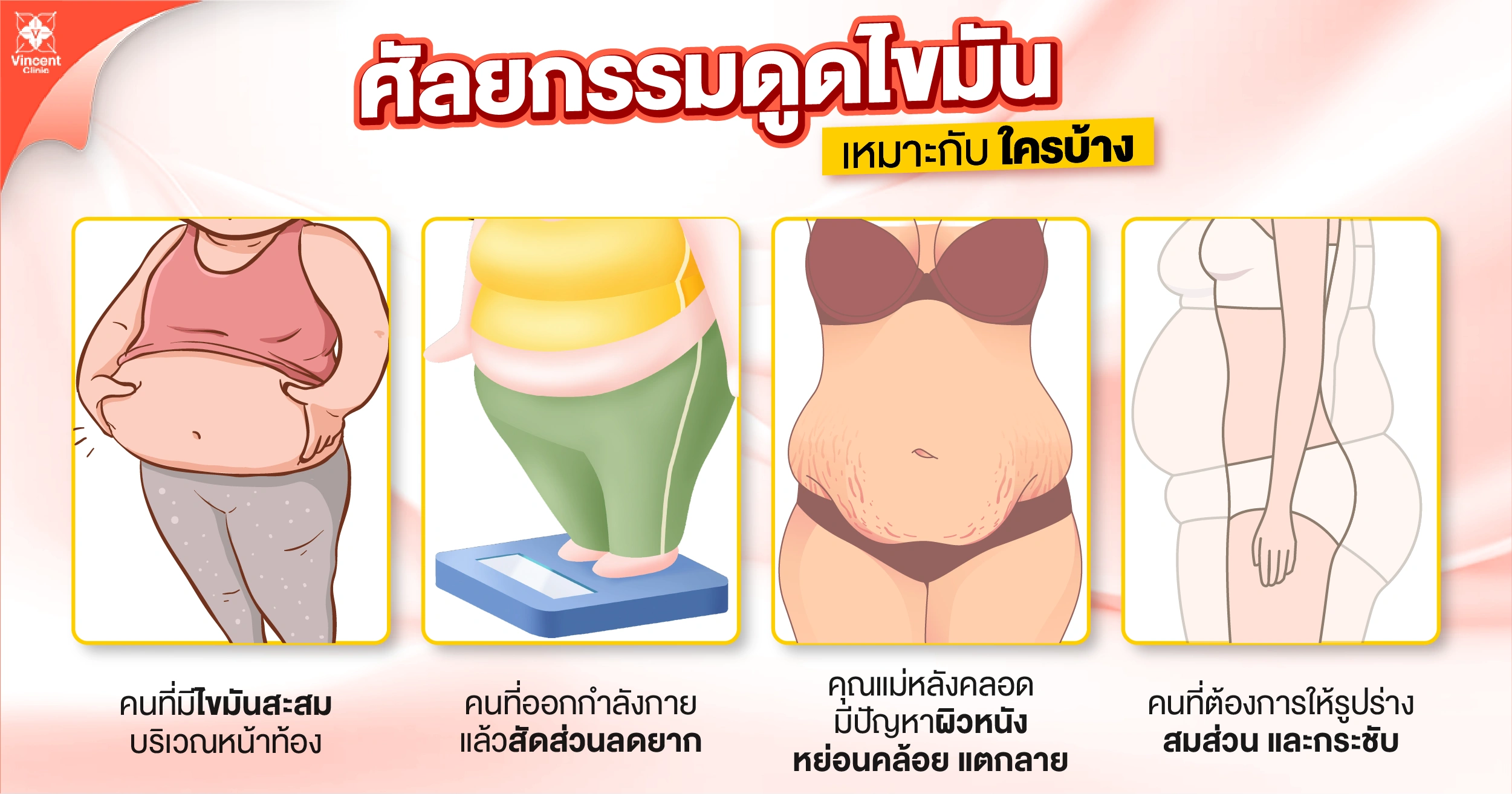 ดูดไขมันหน้าท้อง เหมาะกับใครบ้าง