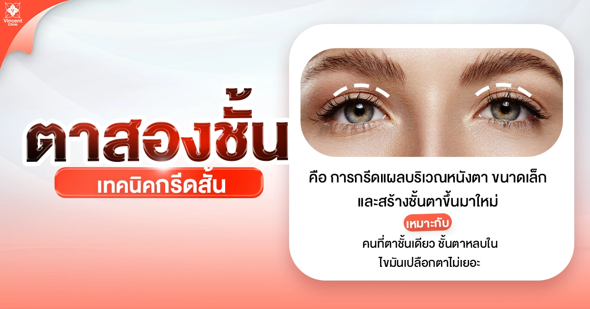 ทำไมเทคนิคกรีดสั้นถึงได้รับความนิยม?