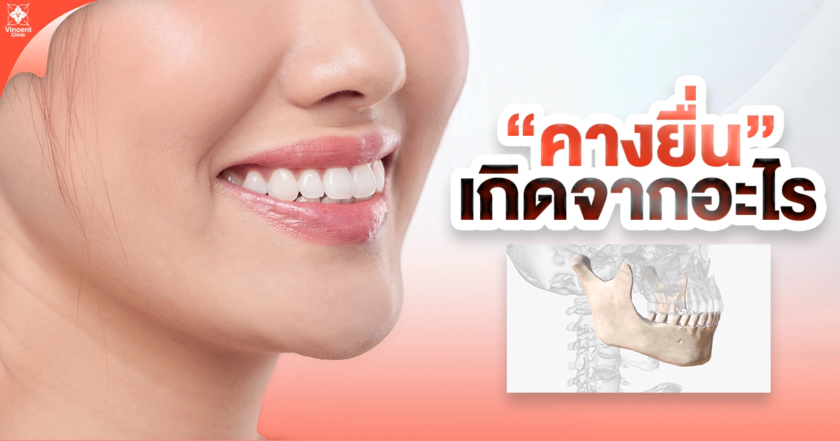 สาเหตุของคางยื่นเกิดจากอะไรได้บ้าง
