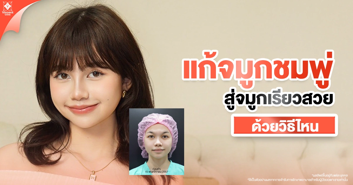 เทคนิคแก้จมูกชมพู่มีอะไรบ้าง?