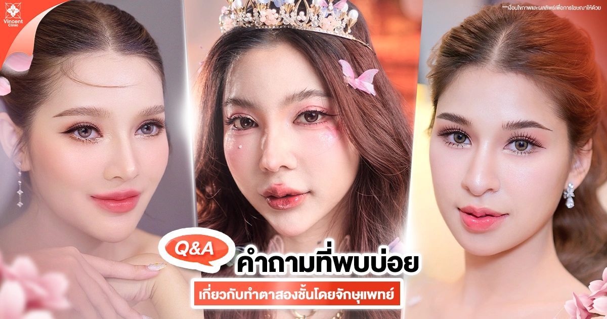 คำถามที่พบบ่อยเกี่ยวกับการทำตาสองชั้นกับจักษุแพทย์