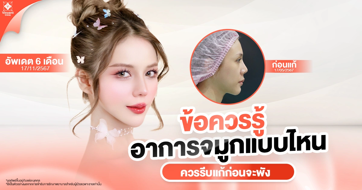 อาการแบบไหนควรแก้จมูก
