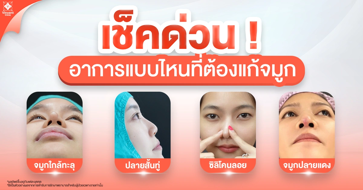 สัญญาณเตือน จมูกแบบไหนที่ควรพิจารณาแก้ไข