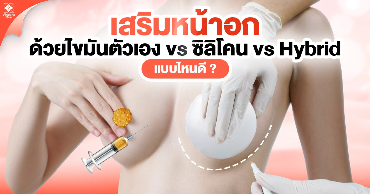 เสริมหน้าอกด้วยไขมัน vs ซิลิโคน vs hybrid