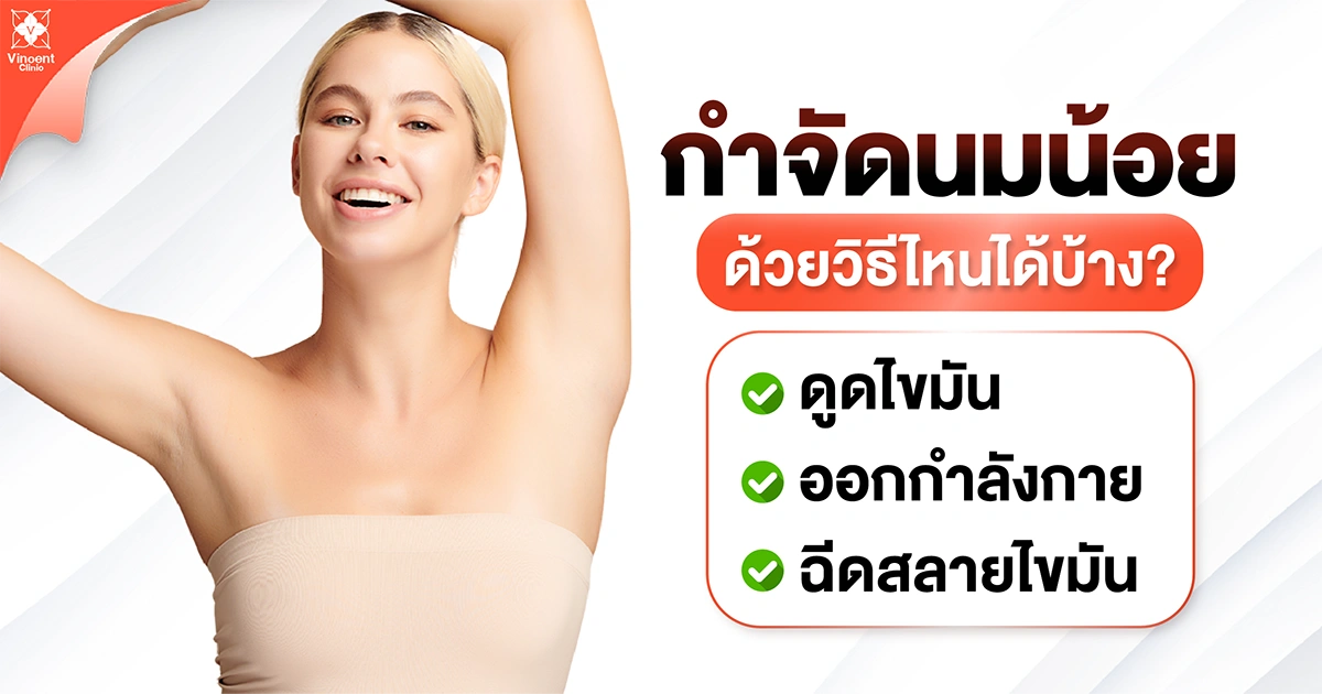 กำจัดนมน้อยด้วยวิธีใดได้บ้าง