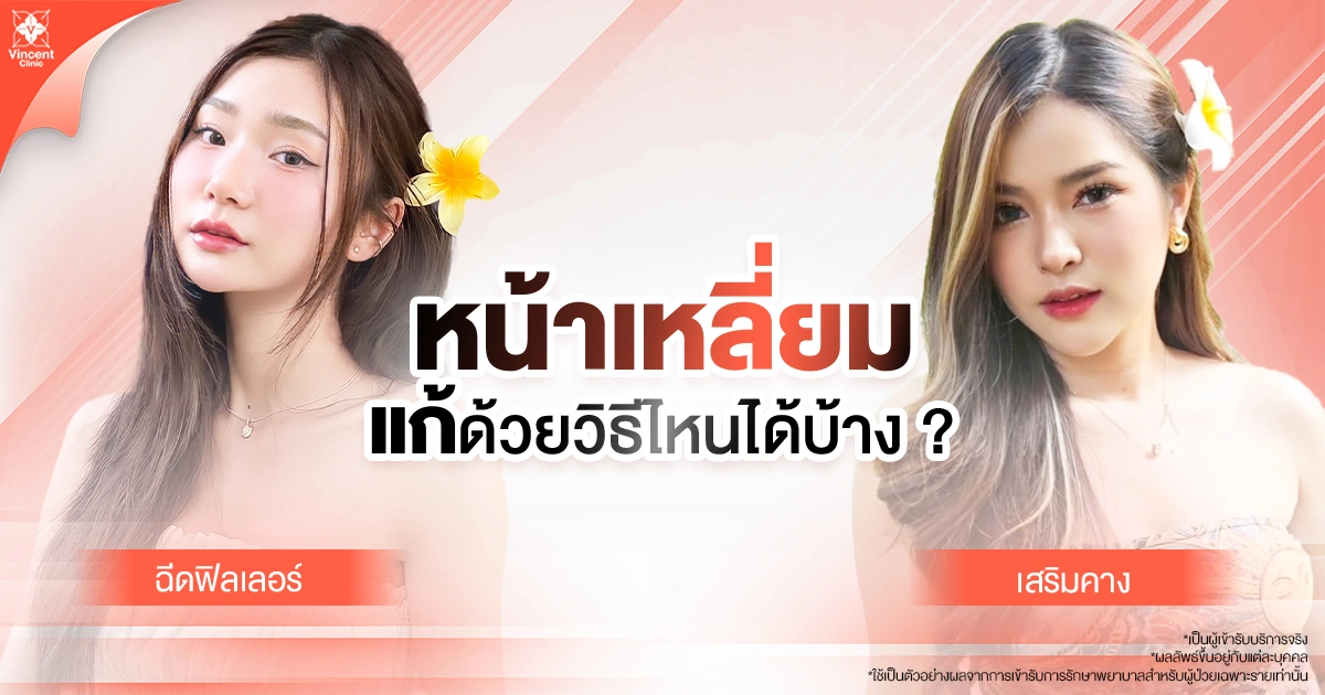 เสริมคางหน้าเหลี่ยม ได้ด้วยวิธีไหนบ้าง?