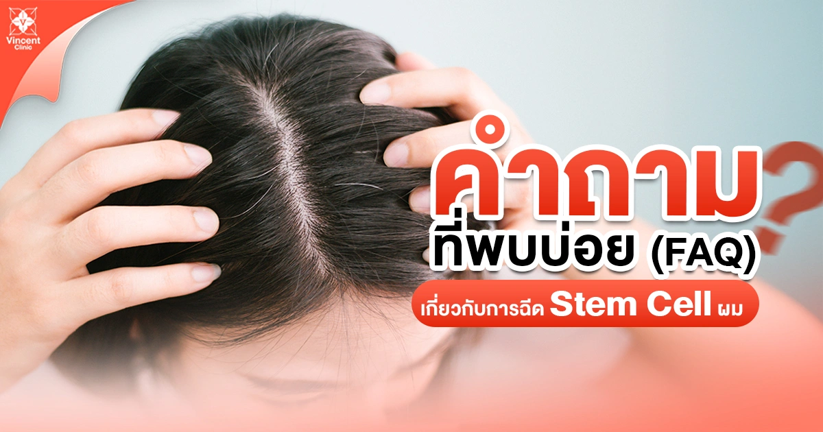 คำถามที่พบบ่อย (FAQ) เกี่ยวกับการฉีดสเต็มเซลล์ผม
