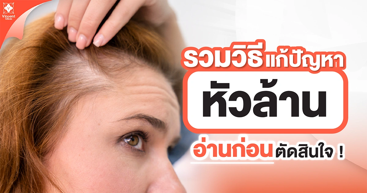 A collection of solutions to solve baldness problems